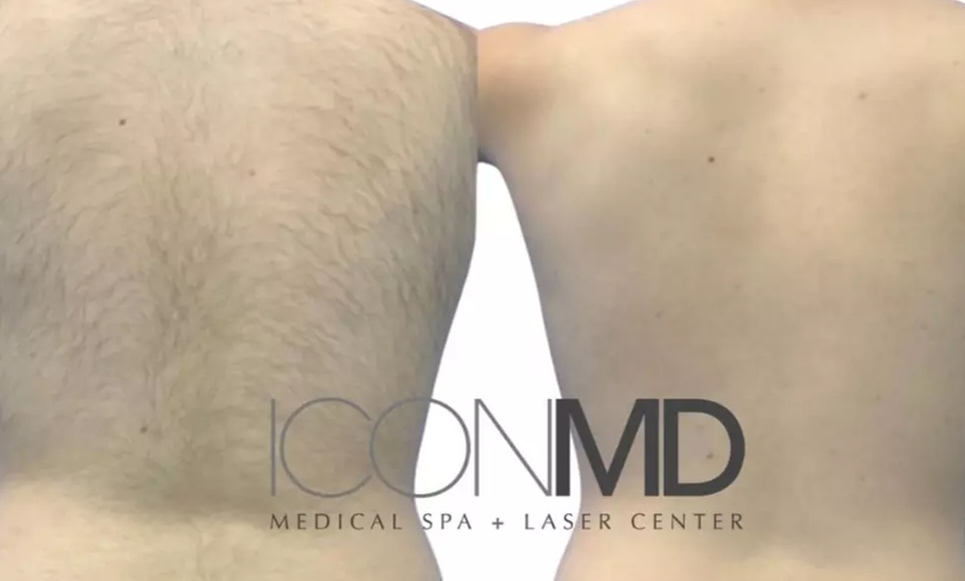 Image 6: Up to 95% Off Laser Hair Removal Icon MD Medical Spa Plus Laser Center