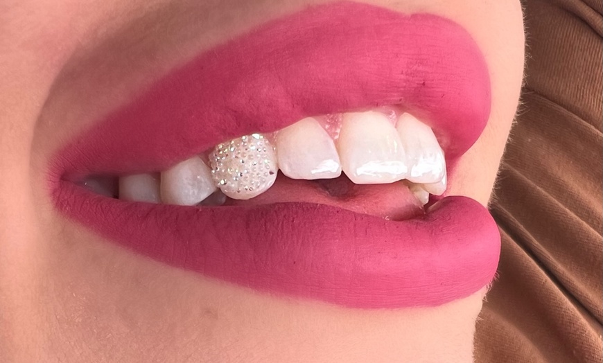 Image 1: Sparkle up with One or Two Tooth Gems for a Bright Smile