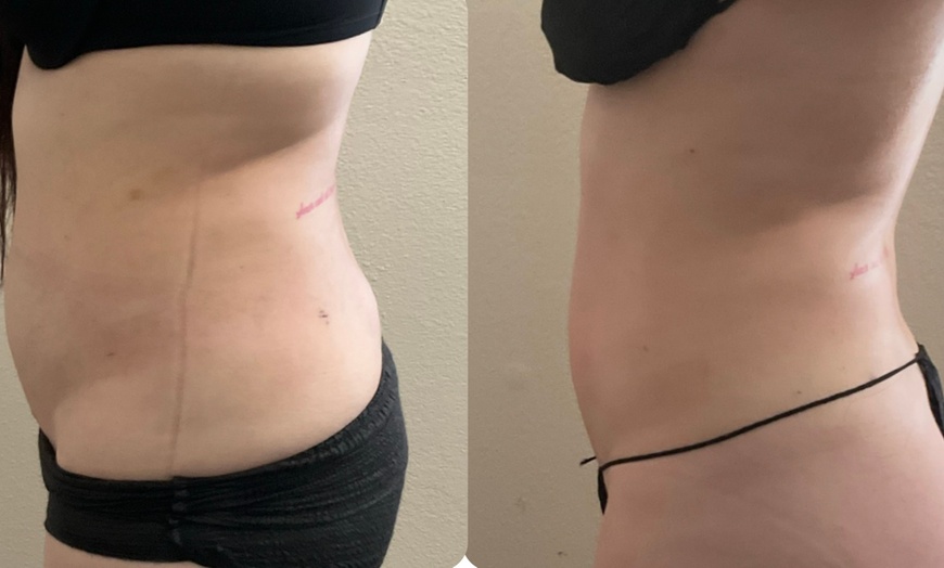 Image 3: 45 or 60-Minute Post-Op Massages for Optimized Surgical Recovery