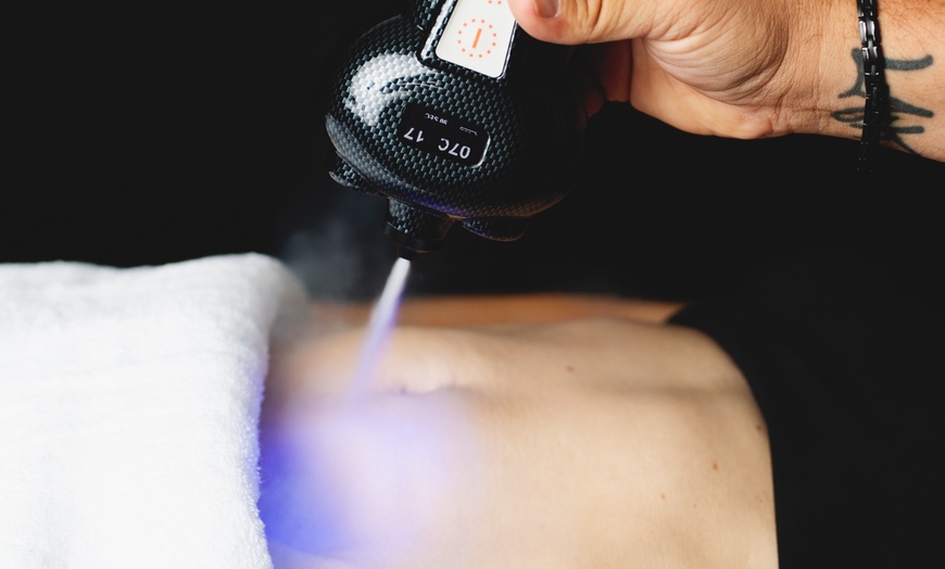 Image 4: Cryoslimming for Stubborn Abdominal Fat: No Surgery, No Downtime