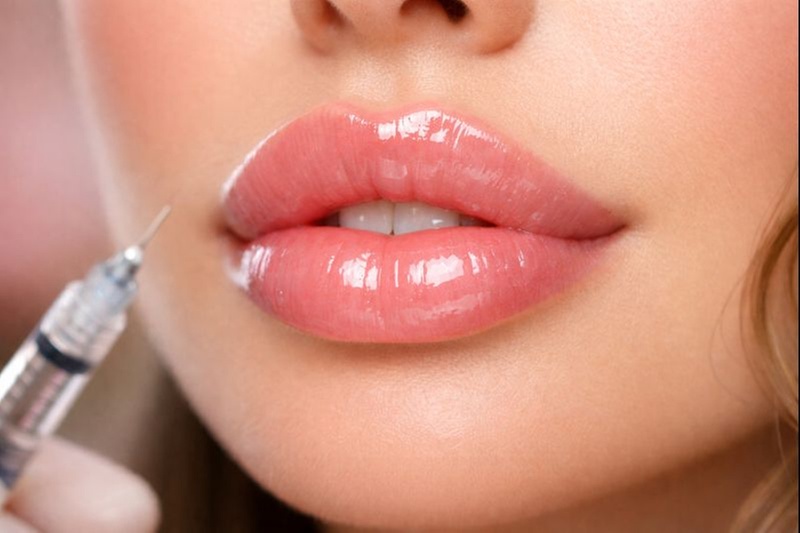 Up to 67% Off on Lip Filler at Adara Beauty and Wellness