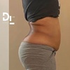 Image 2: Redefine Body with One, Four or Eight Fat Reduction Sessions