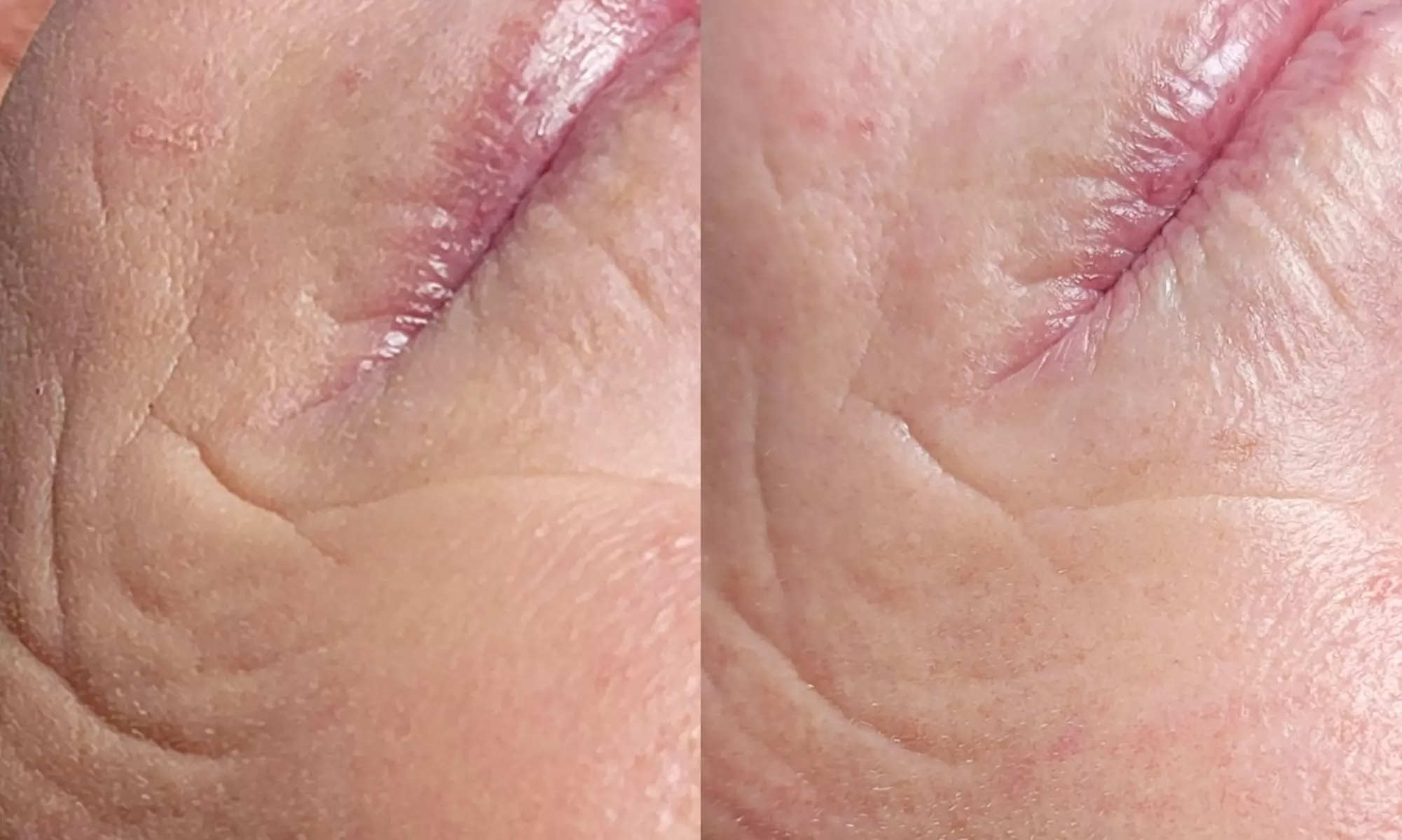 Spa Gift Certificates for Relaxing Massage & Facial Treatments