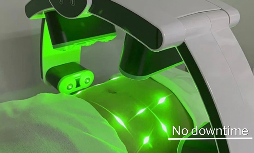 Image 2: Green Laser Lipo Fat Reduction - Up To 4 inches Loss