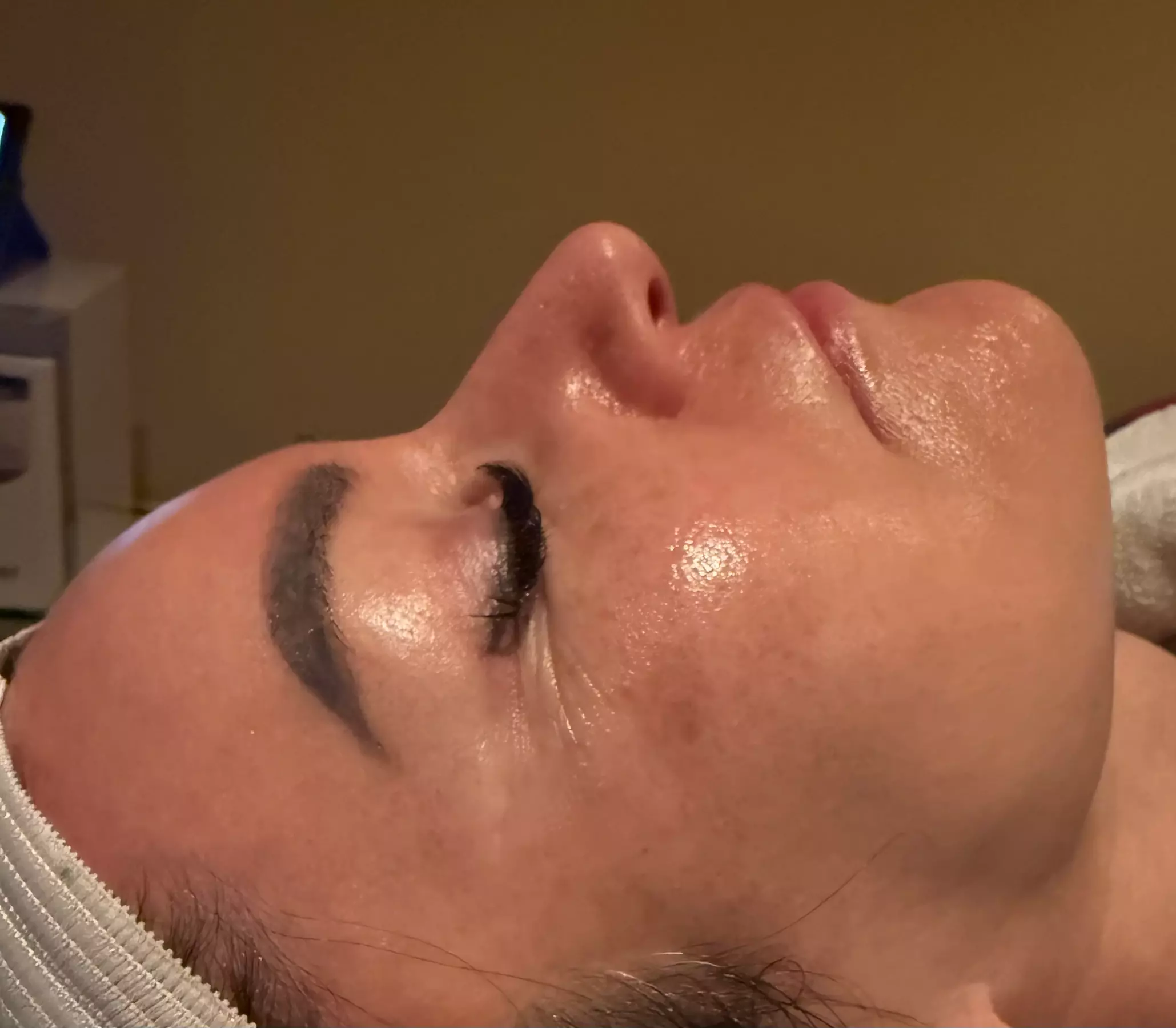 Get the Youthful Glow with Specialized Anti Aging Skin Treatment