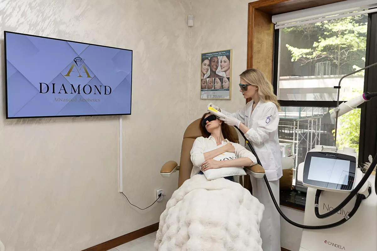 IPL for Hands or Full Face