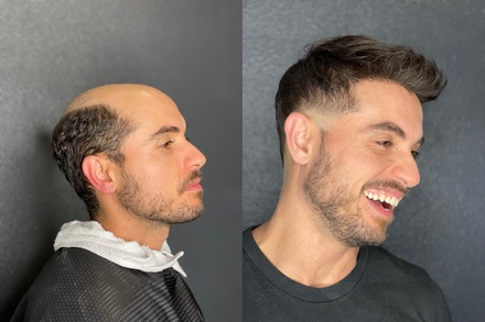 Hair system clean up- Scalp treatment shampoo- reinstall - Strandly hair