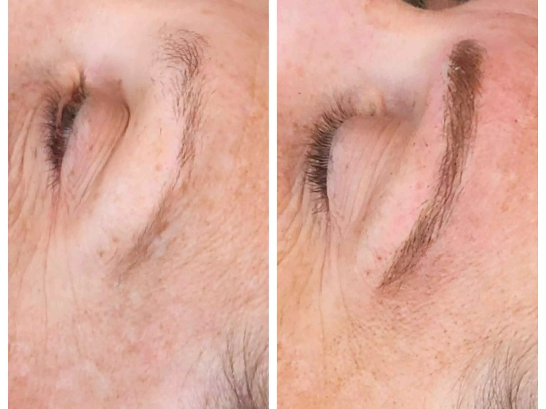 Perfect Brows with One Microblading Session with or without Touch-Up