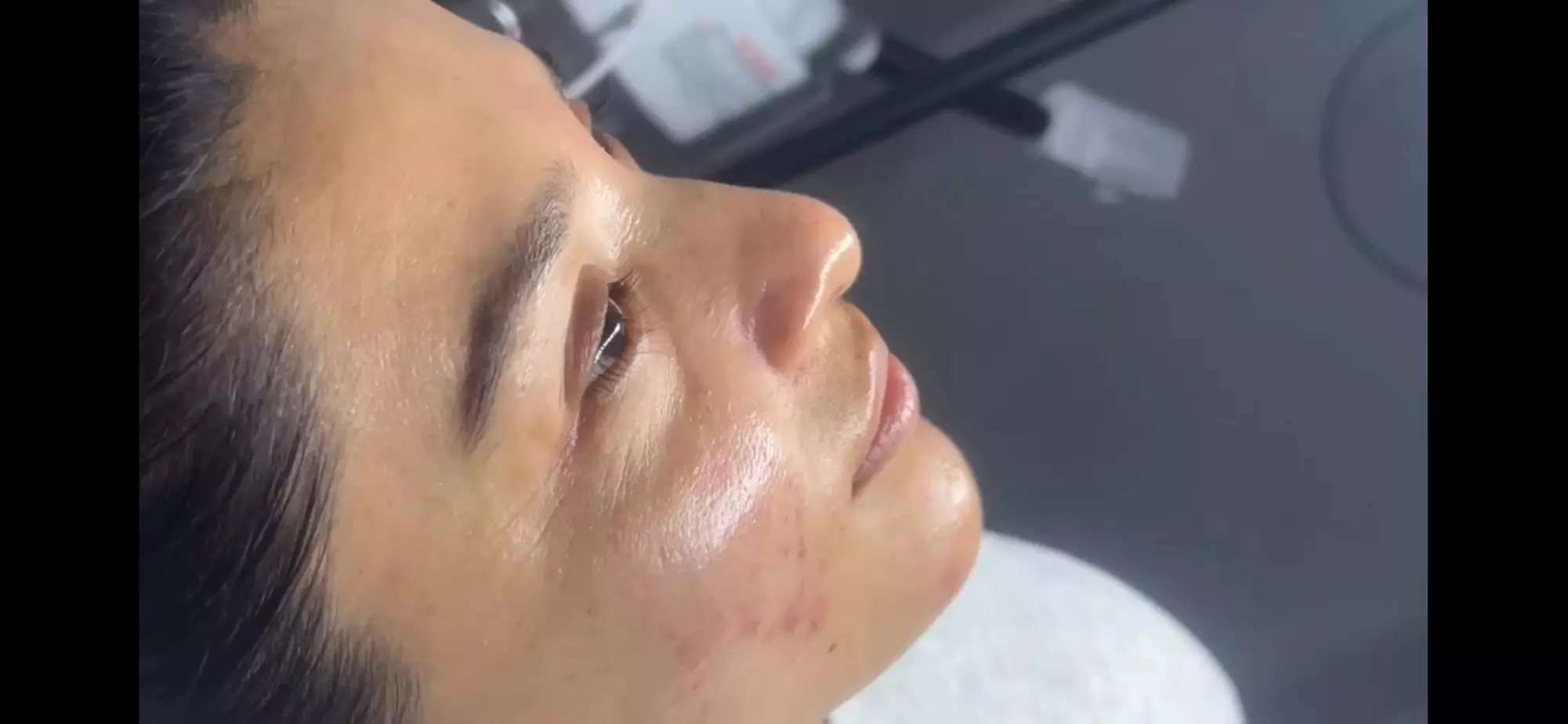 One or Three Non-Surgical Face Lift: RF, Ultrasound & Cryo LED Facial 