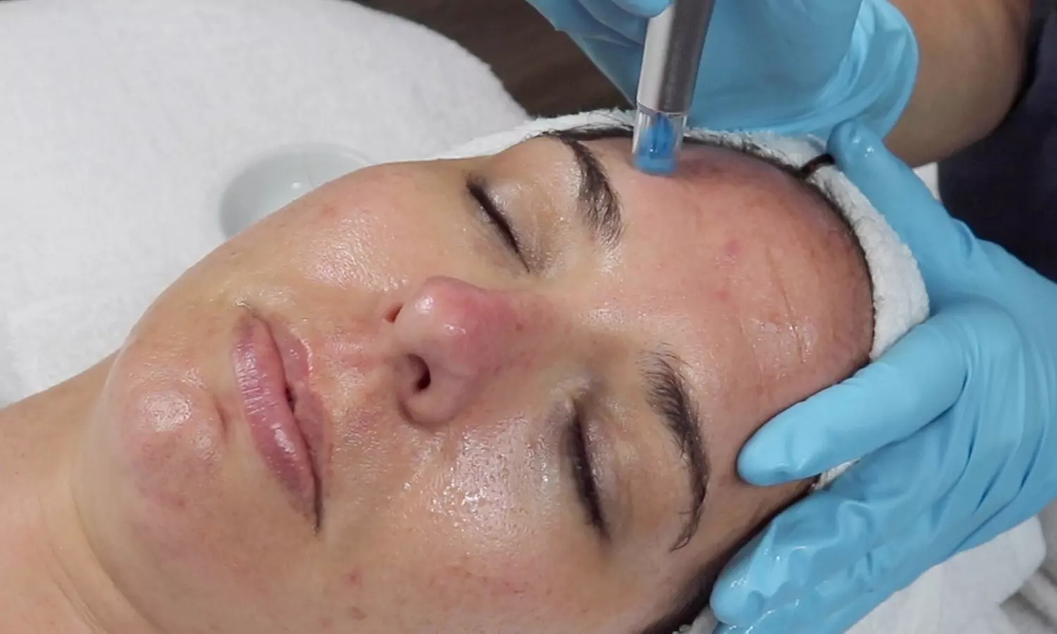 Up to 50% Off on Facial at Purpose Advanced Esthetics - Second Medium
