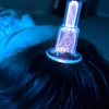 Image 4: Cold & Hot Plasma Fusion Rejuvenation for Youthful Skin