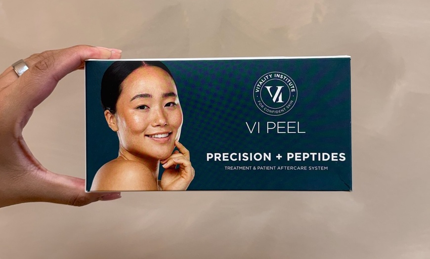 Image 3: Shed Sun Spots & Glow: VI Chemical Peel + Full Aftercare Kit