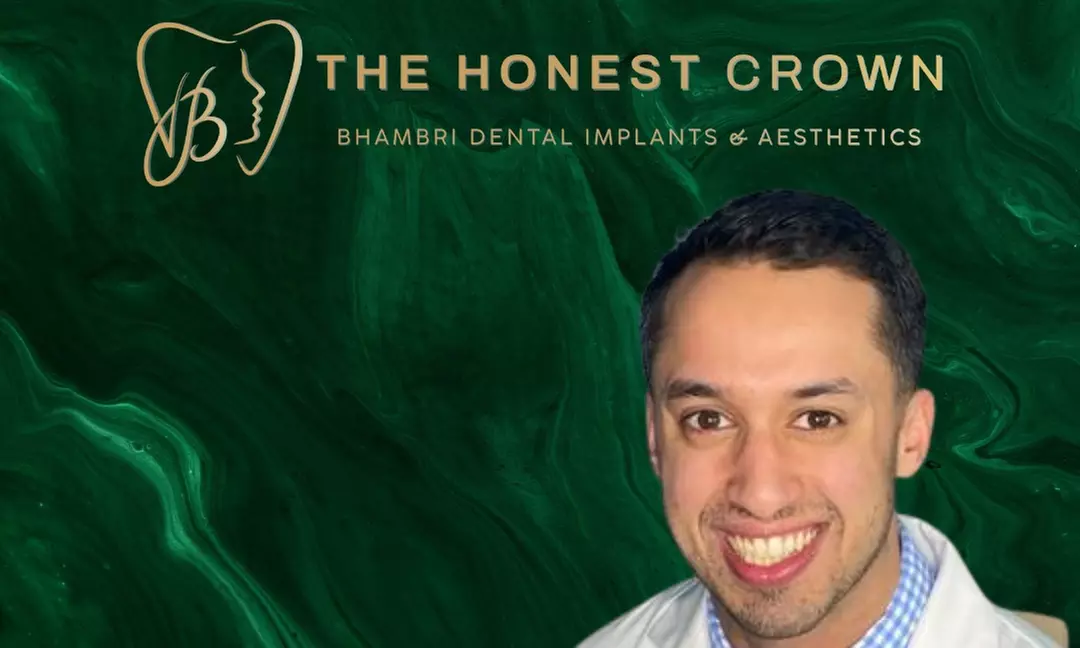 Transform Your Smile: One, Two or Three Dental Implants with Abutments and Crowns - Up to 30% Off - Second Medium