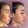 Image 2: Up to 38% Off on Injection - Dermal Filler at Divine Aesthetics Clinic London