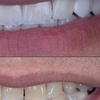 Image 4: Dental Crowns, Dental Exam, X-rays & Cleaning, Dentures & More