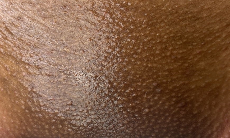 Image 7: Get Smooth with 1, 3, 5, or 10 Brazilian/Bikini Wax Sessions