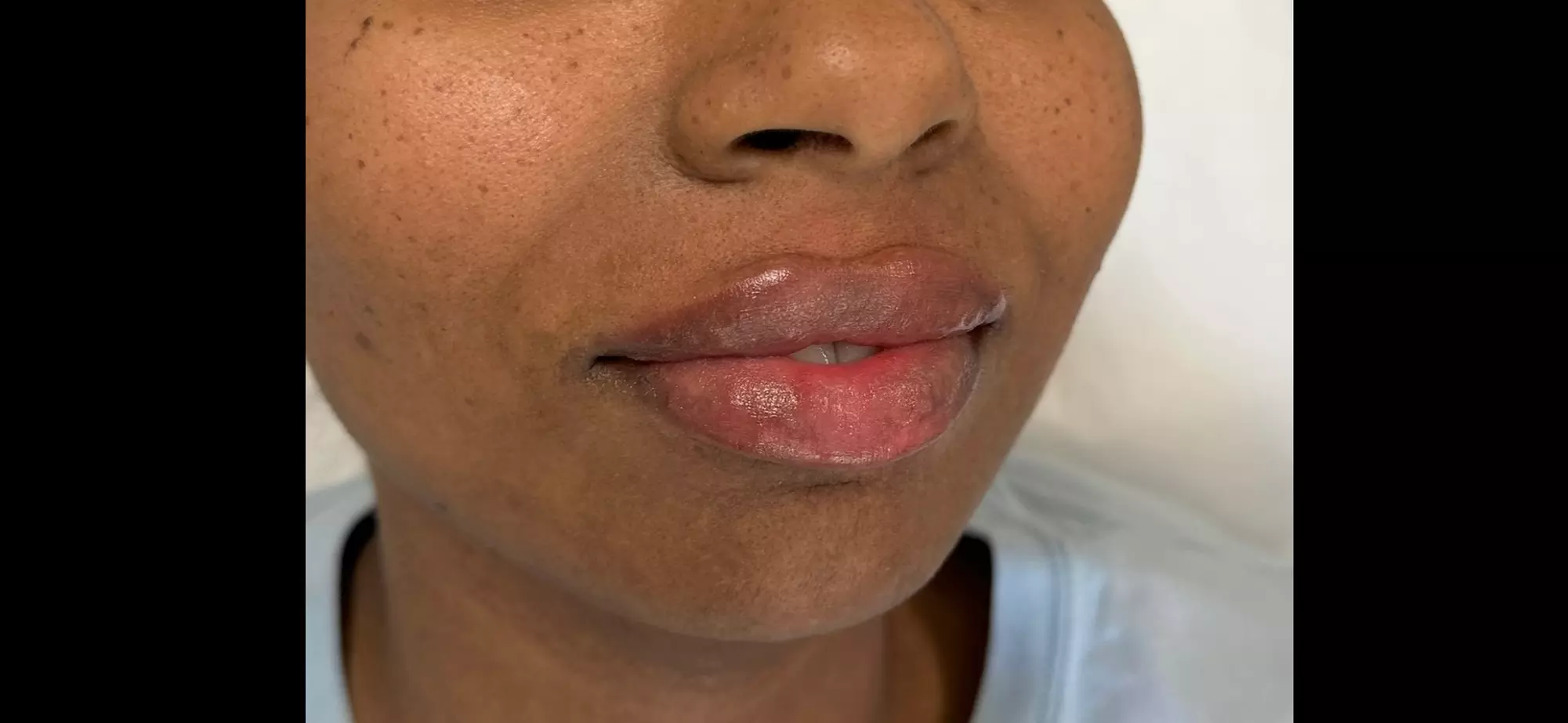 Up to 47% Off on  at Dermaesthetics