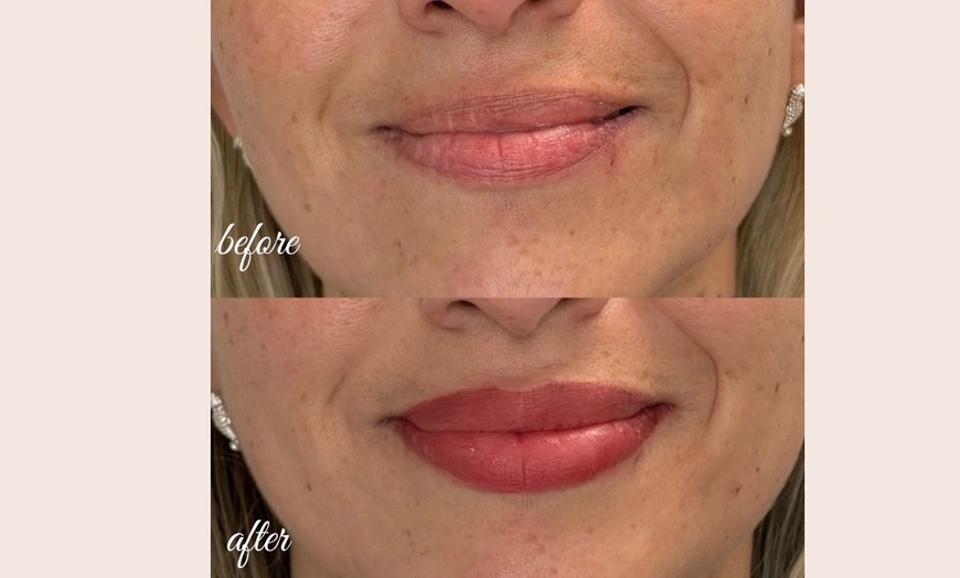 Image 8: Defined Brows & Lips with Microblading or Lip Blush