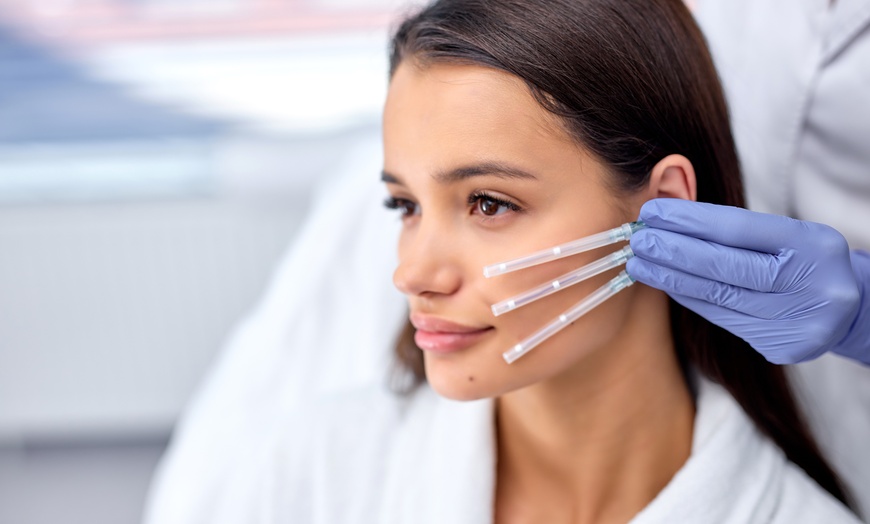 Image 1: PDO Thread lift and Rejuvenation for Face and Neck!