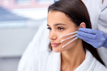 Six PDO Smooth Treads  - Be Rejuved Wellness Studio