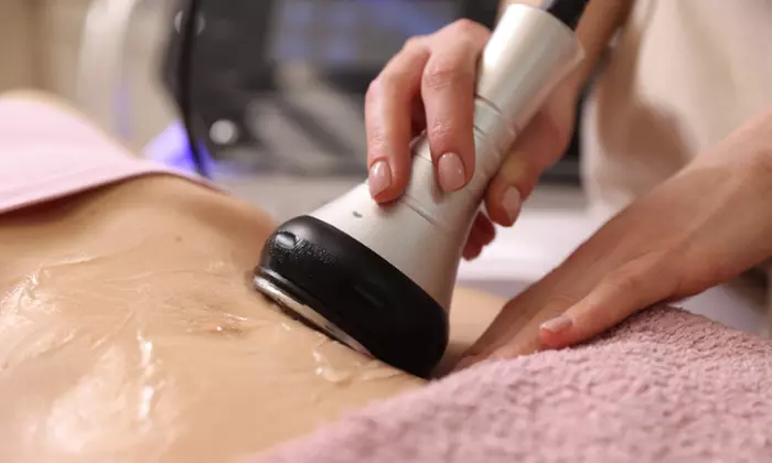 Get Radio Frequency Treatment (1, 2 Small, or Large Areas )