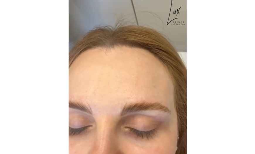 Image 7: Up to 56% Off on Eyebrows Laminations at Lux clinic