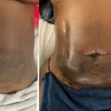 Image 4: Post-Op Lymphatic Massage at Post op curves(Up to 60% Off)