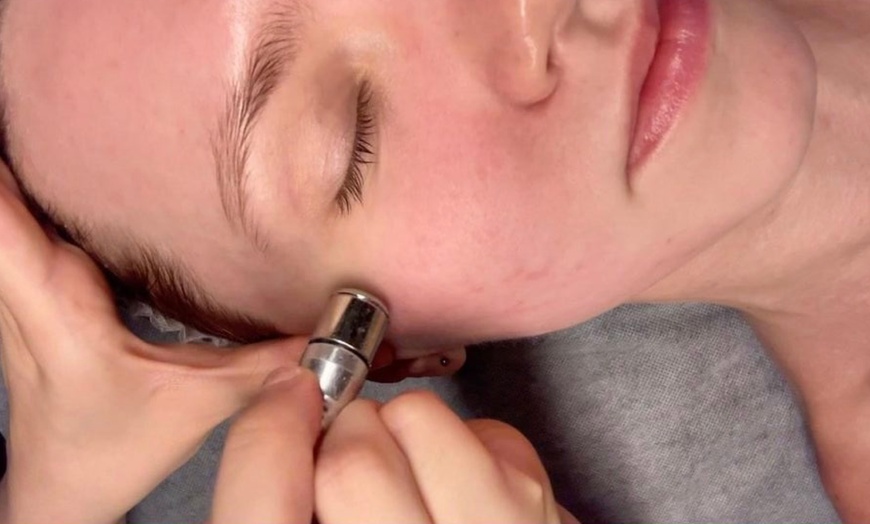 Image 2: One or Three Sessions of Diamond Dermabrasion Skin Peeling Sessions