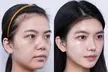 Up to 84% Off on HydraFacial at Magic Beauty Wellness - Second Medium