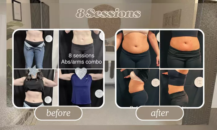 Up to 70% Off on Fat Reduction - BodyTone