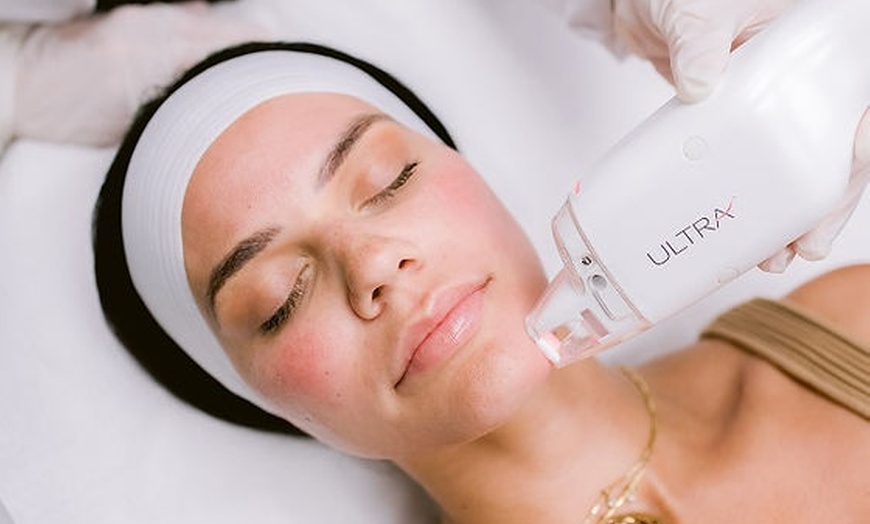 Image 3: Non-Ablative Fractional Laser - LaseMD Ultra for Stretch Marks, Face, Neck, or Hands at Loma Laser (Up to  45% Off)