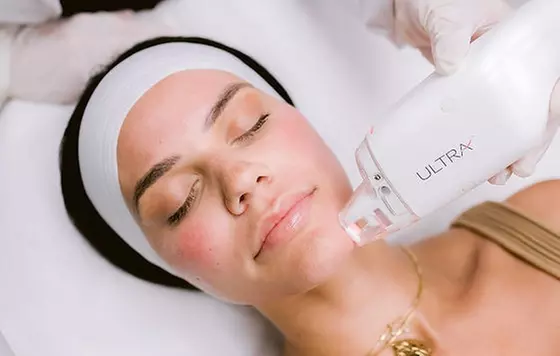 Non-Ablative Fractional Laser - LaseMD Ultra for Stretch Marks, Face, Neck, or Hands at Loma Laser (Up to  45% Off)