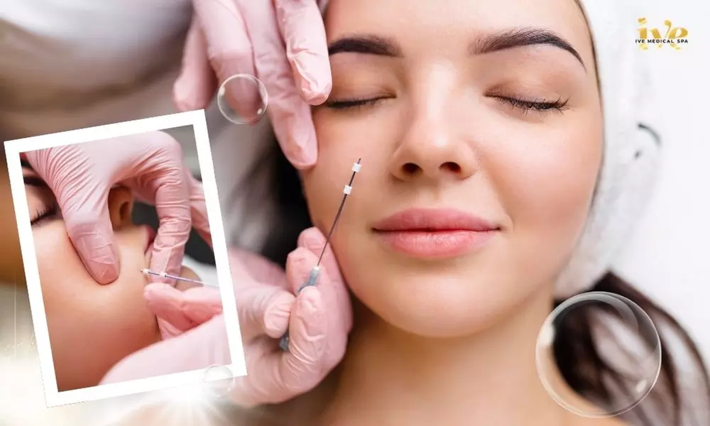 PDO or PCL Thread Lift Session: Jawline, Neck with Optional Nose, Face