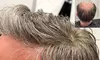 Get Hair Systems at Gorgeous Hair Salon - Tops and Locs - Up to 46% Off 