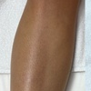 Image 4: Effortless Smoothness with 3 or 6 Laser Hair-Removal Sessions on Small, Medium or Large Area (Up to 84%Off)