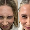 Image 1: Smooth Away Wrinkles with 20, 40 or 60 Units of Xeomin