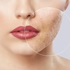 Image 1: Up to 55% Off on PRP Facelift at Marjan Spa