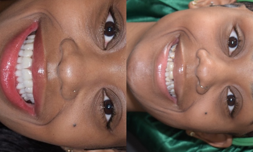Image 6: Dental Crowns, Dental Exam, X-rays & Cleaning, Dentures & More
