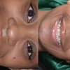 Image 6: Dental Crowns, Dental Exam, X-rays & Cleaning, Dentures & More