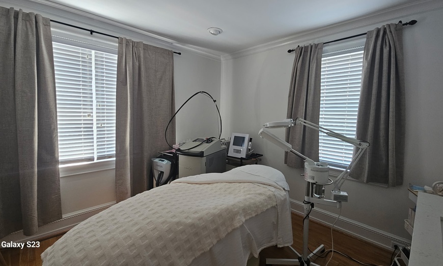 Image 2: Up to 78% Off Microdermabrasion