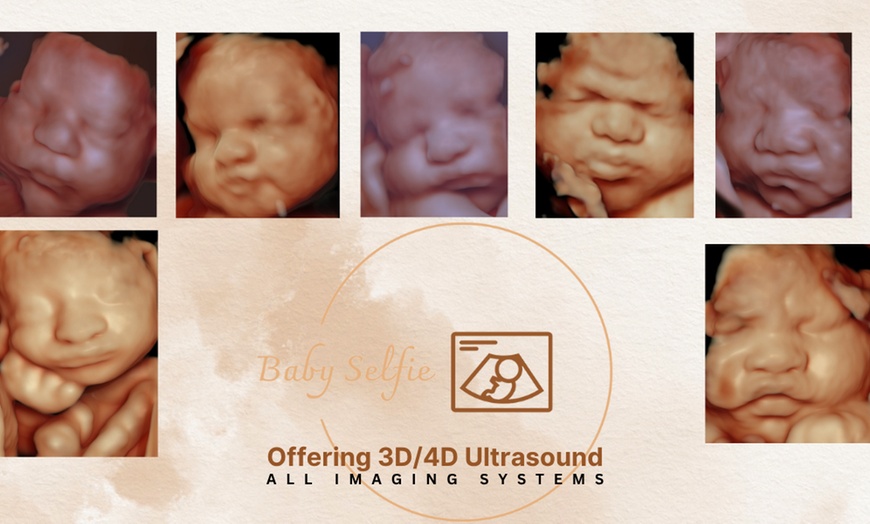 Image 5: Up to 30% Off on Ultrasound - 3D / 4D at BabySelfie
