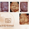 Image 5: Up to 30% Off on Ultrasound - 3D / 4D at BabySelfie