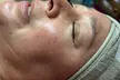 One or Two 50-Minute Pampering Facial Packages with High Frequency Hair Comb for Hair Growth (Up to 50% Off) - Second Medium