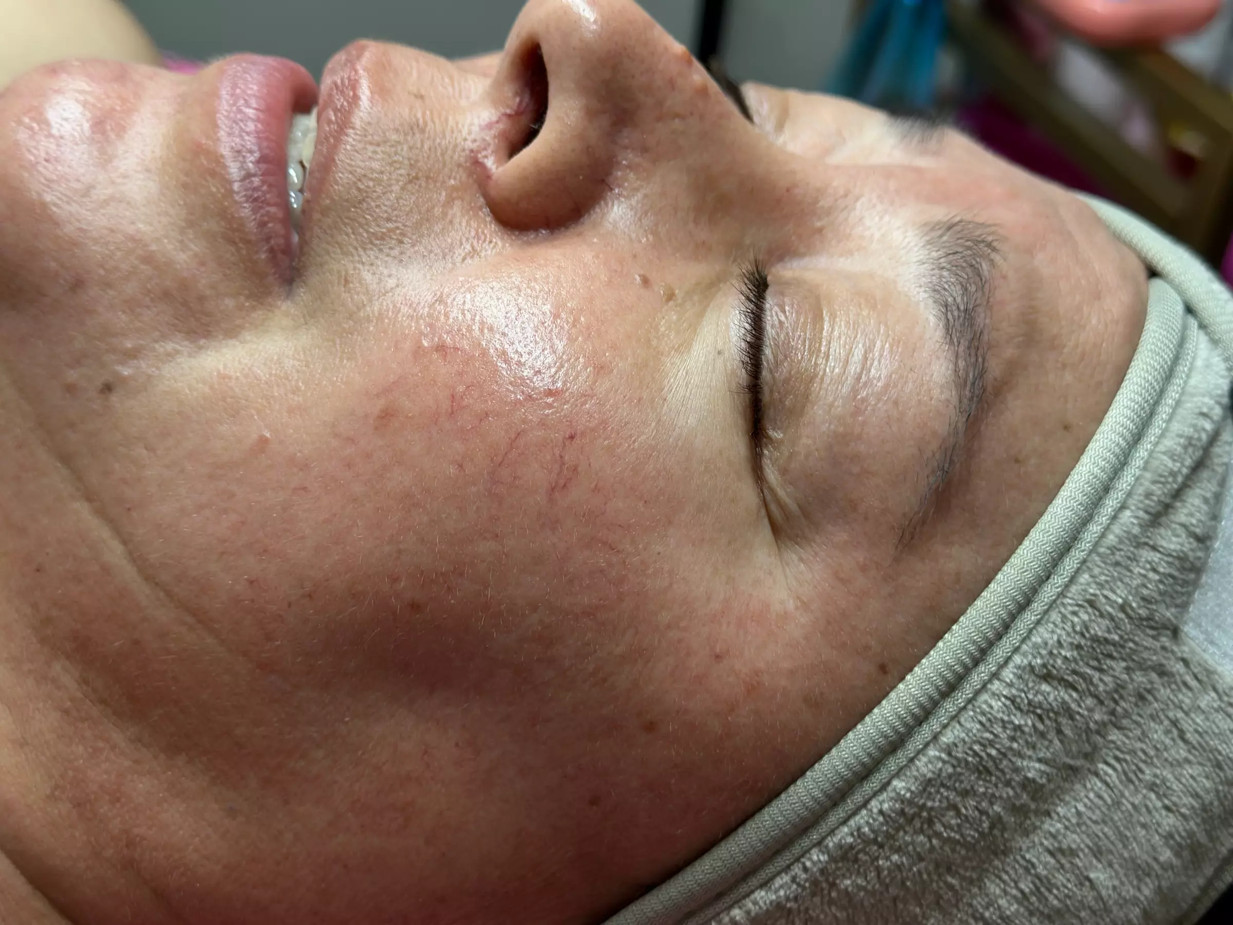 Pampering Facial Package with High Frequency Hair Comb for Hair Growth