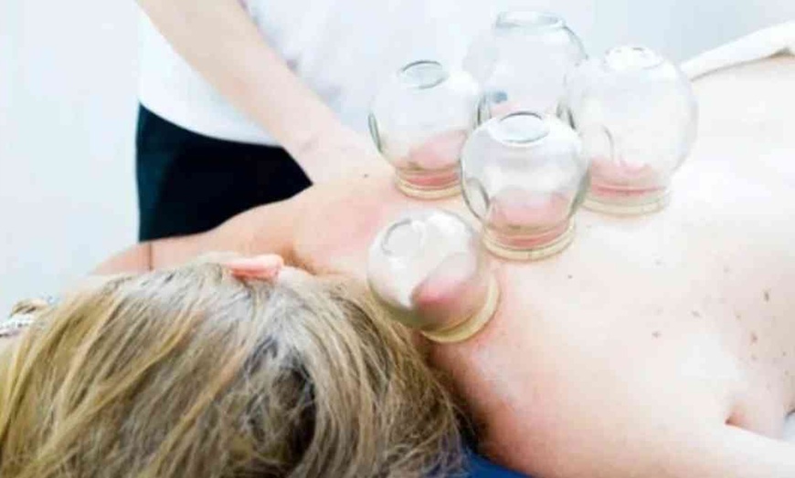 Image 1: Bis zu 46% Rabatt auf Schröpfen bei Zentrum für Lebensenergie