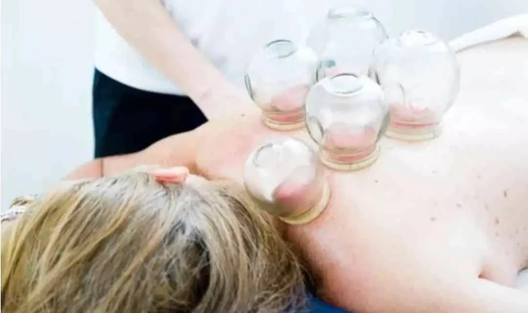 Bis zu 46% Rabatt auf Schröpfen bei Zentrum für Lebensenergie Inh. Yasemin Yigit-Akyol - Primary Image