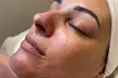 Experience RefreshSkinTherapy's 60-Minute Deep Cleanse Facial or Bye Peach Dermaplane Facial (Up To 25% Off) - Image 2