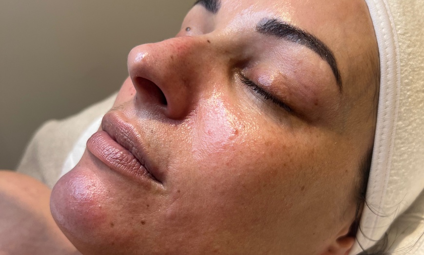 Image 2: Relax with a 60-Min Deep Cleanse Facial or Bye Peach Dermaplane Facial