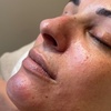 Image 2: Relax with a 60-Min Deep Cleanse Facial or Bye Peach Dermaplane Facial
