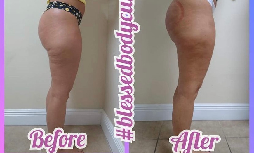 Image 3: Up to 84% Off on Lipo - Non-Invasive Laser-iLipo at Blessed Body Curves